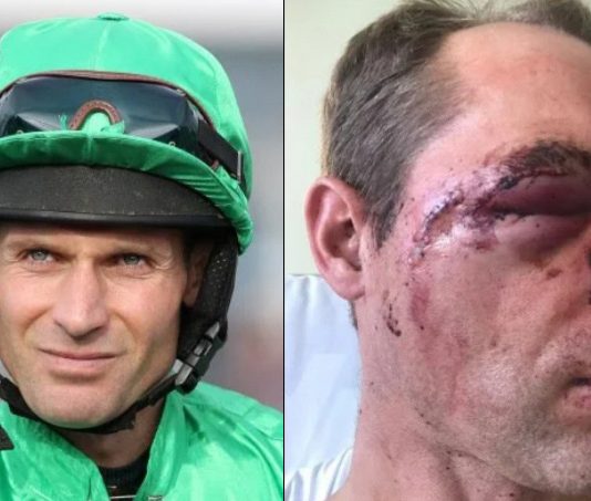 Cook suffered a fractured eye socket requiring 60 stitches to facial injuries following fall at Market Rasen in October.