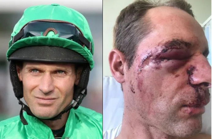 Cook suffered a fractured eye socket requiring 60 stitches to facial injuries following fall at Market Rasen in October.